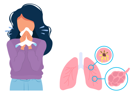 COPD coughing graphic 2 