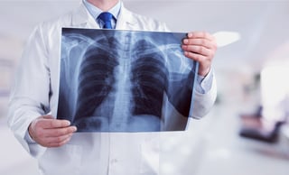 doctor looking at lung xray.jpg