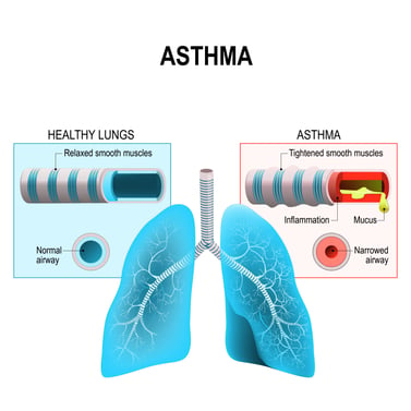healthy versus asthmatic lungs