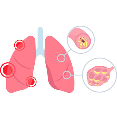 young person with COPD 9